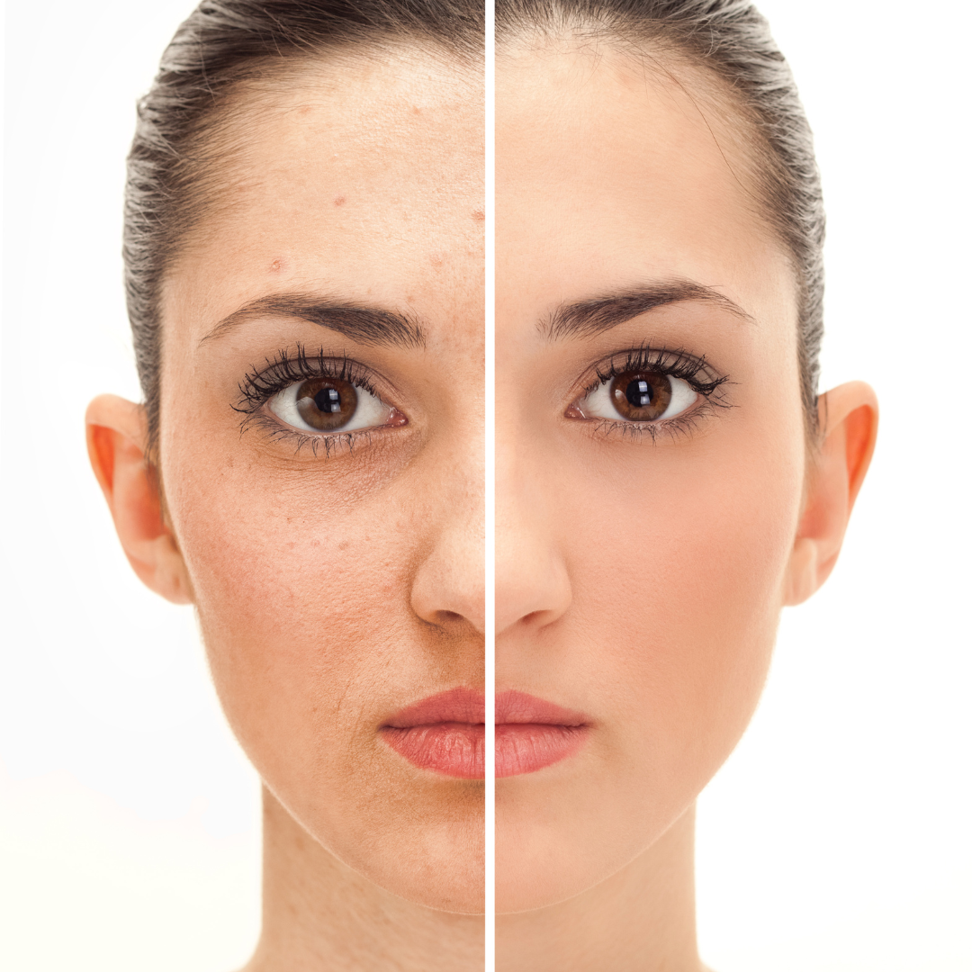 Comment avoir une plus belle peau ?